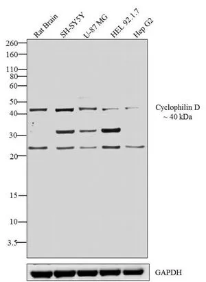 WB analysis of whole cell extracts (30 ug lysate) of Rat Brain (Lane 1), SH-SY5Y (Lane 2), U-87 MG (Lane 3), HEL 92.1.7 (Lane 4), and Hep G2 (Lane 5) using GTX25902 Cyclophilin 40 antibody. Dilution : 1:500-1:2000 WB analysis of whole cell extracts (30 ug lysate) of Rat Brain (Lane 1), SH-SY5Y (Lane 2), U-87 MG (Lane 3), HEL 92.1.7 (Lane 4), and Hep G2 (Lane 5) using GTX25902 Cyclophilin 40 antibody. Dilution : 1:500-1:2000