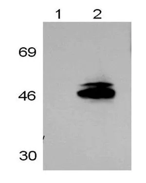 WB analysis of human HEK293 cells using GTX25904 Retinoic Acid Receptor gamma antibody. Lane 1 : Primary antibody with blocking peptide Lane 2 : Primary antibody
