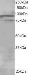 WB analysis of human brain lysate using GTX25934 OSBPL11 antibody, C-term. Dilution : 1microg/ml Loading : 30microg protein in RIPA buffer WB analysis of human brain lysate using GTX25934 OSBPL11 antibody, C-term. Dilution : 1microg/ml Loading : 30microg protein in RIPA buffer