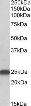 WB analysis of rat brain lysate using GTX25967 LIN7B antibody, N-term. Dilution : 0.5microg/ml Loading : 35microg protein in RIPA buffer WB analysis of rat brain lysate using GTX25967 LIN7B antibody, N-term. Dilution : 0.5microg/ml Loading : 35microg protein in RIPA buffer