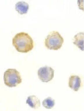 Immunocytochemical staining of DcR1 in HeLa cells with DcR1 antibody (GTX25975) at 10microg/ml. Immunocytochemical staining of DcR1 in HeLa cells with DcR1 antibody (GTX25975) at 10microg/ml.
