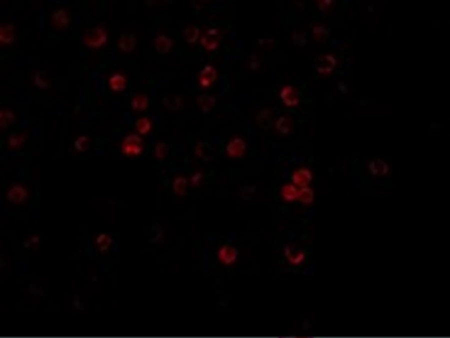 ICC/IF analysis of HeLa cells using GTX25975 DcR1 antibody. Dilution : 20 microg/ml