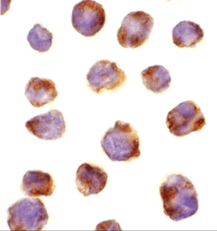 ICC/IF analysis of K562 cells using GTX25985 IRAK4 antibody. Dilution : 10 microg/ml ICC/IF analysis of K562 cells using GTX25985 IRAK4 antibody. Dilution : 10 microg/ml