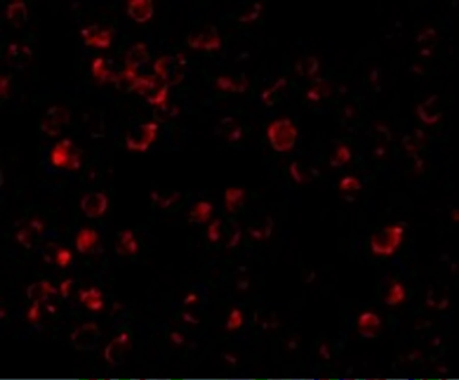 ICC/IF analysis of K562 cells using GTX25985 IRAK4 antibody. Dilution : 10 microg/ml