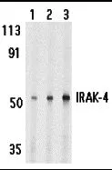 WB analysis of HeLa cell lysate using GTX25985 IRAK4 antibody. Dilution : 1microg/ml (Lane A), 2 microg/ml (Lane B), and 4microg/ml (Lane C)