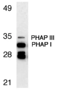Western blot analysis of PHAP expression in Raji cell lysate with PHAP antibody (GTX25987) at 1microg/ml. The two bands below PHAP I might be differently spliced isoforms of PHAP.