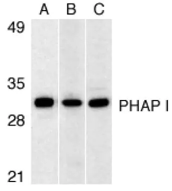 Western blot analysis of PHAP I expression in human Raji cell (A), mouse (B) and rat (C) testis tissue lysates with PHAP I antibody (GTX25991) at 1microg/ml.