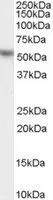 WB analysis of HeLa lysate using GTX26036 KPNA2 antibody, C-term. Dilution : 0.03microg/ml Loading : 35microg protein in RIPA buffer WB analysis of HeLa lysate using GTX26036 KPNA2 antibody, C-term. Dilution : 0.03microg/ml Loading : 35microg protein in RIPA buffer