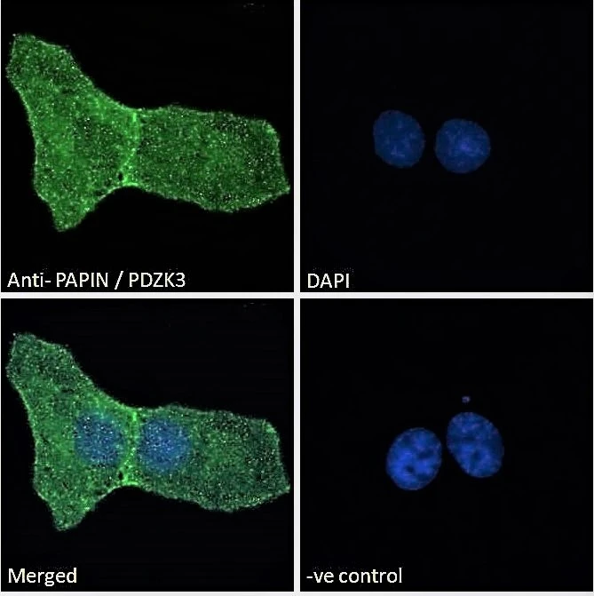 ICC/IF analysis of paraformaldehyde fixed U2OS cells using GTX26037 PDZK3 antibody, N-term. Green : Primary antibody Blue : DAPI Negative control: Unimmunized goat IgG Dilution : 10microg/ml ICC/IF analysis of paraformaldehyde fixed U2OS cells using GTX26037 PDZK3 antibody, N-term. Green : Primary antibody Blue : DAPI Negative control: Unimmunized goat IgG Dilution : 10microg/ml