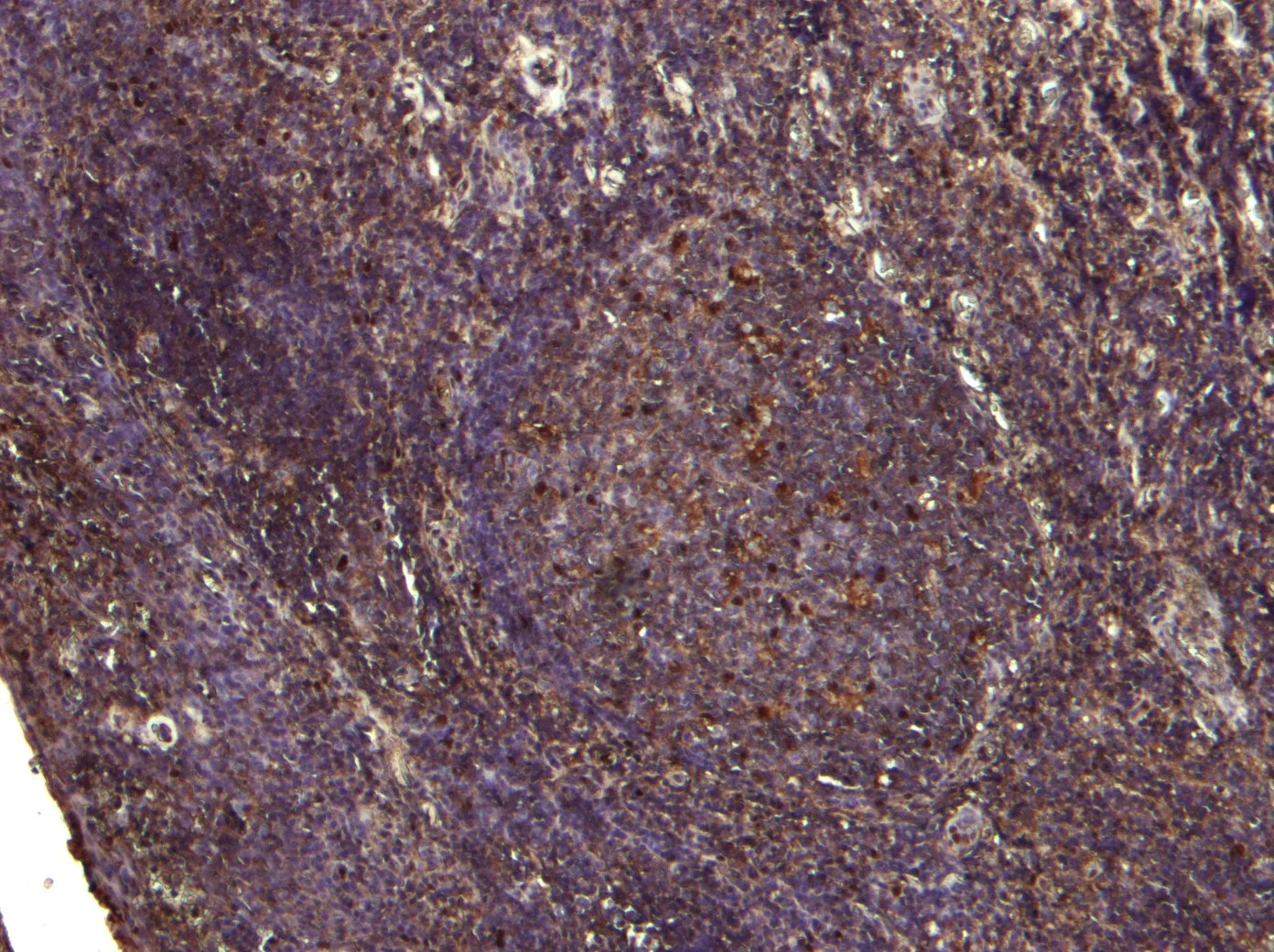 IHC-P analysis of human tonsil tissue using GTX26037 PDZK3 antibody, N-term.