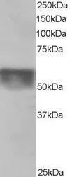 WB analysis of human testis lysate using GTX26039 KPNA4 antibody, C-term. Dilution : 0.5microg/ml Loading : 35microg protein in RIPA buffer WB analysis of human testis lysate using GTX26039 KPNA4 antibody, C-term. Dilution : 0.5microg/ml Loading : 35microg protein in RIPA buffer