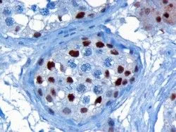 IHC-P analysis of human testis using GTX26039 KPNA4 antibody, C-term. Antigen retrieval : citrate buffer pH 6 Dilution : 3microg/ml