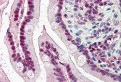 IHC-P analysis of human small intestine using GTX26039 KPNA4 antibody, C-term. Antigen retrieval : citrate buffer pH 6 Dilution : 5microg/ml