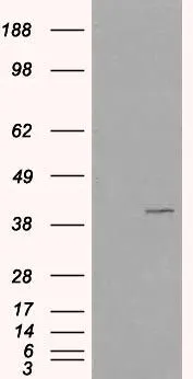 WB analysis of HEK293 overexpressing VPS26A (mock transfection in first lane) using GTX26051 VPS26A antibody, C-term. Loading : 35microg protein in RIPA buffer