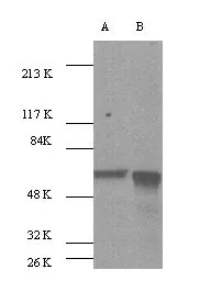 WB analysis of various sample lysates using GTX26076 AKT antibody. Lane 1 : A341 whole cell lysates Lane 2 : NIH-3T3 whole cell lysates