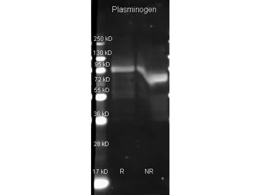 WB analysis of human plasminogen protein using GTX26189 Plasminogen antibody. Lane 1 : Reduced Plasminogen (R) Lane 2 : Non-reduced Plasminogen (NR) Loading : 1 microg Dilution : 1:3000 WB analysis of human plasminogen protein using GTX26189 Plasminogen antibody. Lane 1 : Reduced Plasminogen (R) Lane 2 : Non-reduced Plasminogen (NR) Loading : 1 microg Dilution : 1:3000