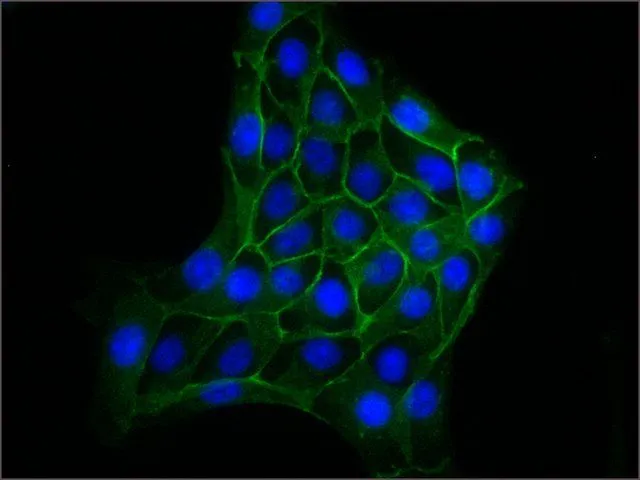 ICC/IF analysis of MDCK cells using GTX26300 beta Catenin antibody[6F9] at 1:500 (green) with DAPI (blue).