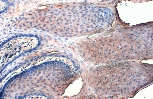 Collagen I antibody [COL-1] detects Collagen I protein at cell membrane by immunohistochemical analysis. Sample: Paraffin-embedded rabbit tongue. Collagen I stained by Collagen I antibody [COL-1] (GTX26308) diluted at 1:200. Antigen Retrieval: Citrate buffer, pH 6.0, 15 min