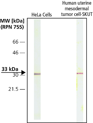 WB analysis of HeLa and human uterine mesodermal tumor cell-SKUT lysates using GTX26315 CDK4 antibody [DCS-31].<br>Dilution : 1:2000
