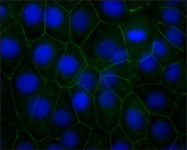 IHC-P analysis of chicken heart tissue using GTX26528 pan Cadherin antibody [CH-19] at 1:500.