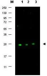 Western blot using GeneTex affinity purified anti-p27 antibody (GTX26547) shows detection of p27 protein in MCF7 whole cell lysate (lanes 1-3) (arrowhead). Separation was achieved using a 4-20% gradient gel. Blocking occurred using 5% BLOTTO. Primary antibody was diluted 1:500 in 1% BLOTTO. The membrane was washed and reacted with a 1:10,000 dilution of Dylight? 800 conjugated Goat anti Rabbit IgG. Molecular weight estimation was made by comparison to prestained MW markers indicated at the left (lane M). Other detection systems will yield similar results. Western blot using GeneTex affinity purified anti-p27 antibody (GTX26547) shows detection of p27 protein in MCF7 whole cell lysate (lanes 1-3) (arrowhead). Separation was achieved using a 4-20% gradient gel. Blocking occurred using 5% BLOTTO. Primary antibody was diluted 1:500 in 1% BLOTTO. The membrane was washed and reacted with a 1:10,000 dilution of Dylight? 800 conjugated Goat anti Rabbit IgG. Molecular weight estimation was made by comparison to prestained MW markers indicated at the left (lane M). Other detection systems will yield similar results.