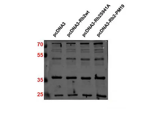 WB analysis of non-transfected and transfected 293T whole cell lysate using GTX26547 p27 Kip1 antibody. Loading : 30 microg Dilution : 1:2000