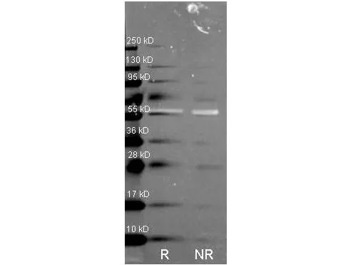 Western Blot of Rabbit anti-Catalase antibody (GTX26573). Lane R: Reduced samples of purified Catalase. Lane NR: Non-reduced samples of purified Catalase. Load: ~1ug of protein per lane. Primary antibody: Catalase antibody at 1:1000 for overnight at 4oC. Secondary antibody: Dylight488? rabbit secondary antibody at 1:10,000 for 1.5 hrs at RT. Block overnight at 4oC. Predicted/Observed size: 59.9 kDa, 55 kDa for catalase. Other band(s): none. Western Blot of Rabbit anti-Catalase antibody (GTX26573). Lane R: Reduced samples of purified Catalase. Lane NR: Non-reduced samples of purified Catalase. Load: ~1ug of protein per lane. Primary antibody: Catalase antibody at 1:1000 for overnight at 4oC. Secondary antibody: Dylight488? rabbit secondary antibody at 1:10,000 for 1.5 hrs at RT. Block overnight at 4oC. Predicted/Observed size: 59.9 kDa, 55 kDa for catalase. Other band(s): none.