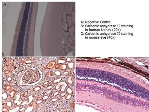 IHC-P analysis of various tissues using GTX26621 Carbonic Anhydrase II antibody. Panel A : Negative control Panel B : Human kidney tissue section Panel C : Mouse eye tissue section Antigen retrieval : Heat-mediated buffer (pH 6.2) Dilution : 4 microg/mL IHC-P analysis of various tissues using GTX26621 Carbonic Anhydrase II antibody. Panel A : Negative control Panel B : Human kidney tissue section Panel C : Mouse eye tissue section Antigen retrieval : Heat-mediated buffer (pH 6.2) Dilution : 4 microg/mL