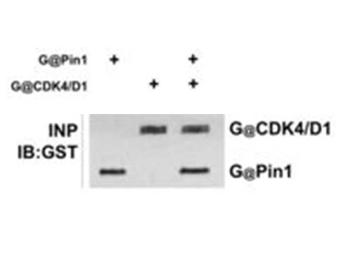 GeneTex anti-GST polyclonal antibody (GTX26633) in western blot shows detection of recombinant GST (indicated by band at 28 kDa). The SDS-PAGE contained approximately 0.2 ug of rGST loaded on to a 4-20% gradient gel for separation.