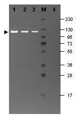 Western blot using GeneTex anti-beta Galactosidase antibody (GTX26641) shows detection of a band at ~117 kDa (lane 1) corresponding to b-Gal present in a partially purified preparation (arrowhead).