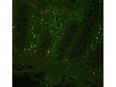 Fluorescent IHC-P staining of human colon using anti-TNF alpha antibody (GTX26671) at a primary antibody dilution of 1:100.