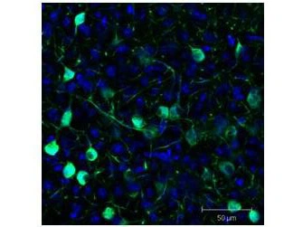 IHC (free floating) analysis of Sf-1:Cre mice crossed to the Z/EG reporter line, Mouse brain using GTX26673 GFP antibody. Green : Primary antibody Blue : DAPI Dilution : 1:500