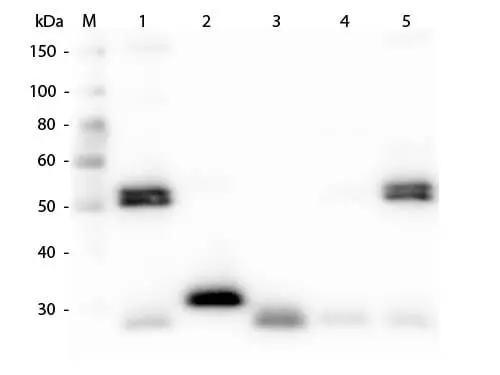 WB analysis of various samples using GTX26838 Chicken Anti-Rat IgG antibody. Lane 1 : Rat IgG Lane 2 : Rat IgG Fc Lane 3 : Rat IgG Fab Lane 4 : Rat IgM Lane 5 : Rat serum Loading : 50 ng Dilution : 1:1000 WB analysis of various samples using GTX26838 Chicken Anti-Rat IgG antibody. Lane 1 : Rat IgG Lane 2 : Rat IgG Fc Lane 3 : Rat IgG Fab Lane 4 : Rat IgM Lane 5 : Rat serum Loading : 50 ng Dilution : 1:1000