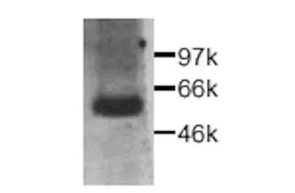 Western blot detection of CTGF fusion protein in transfected supernatant.