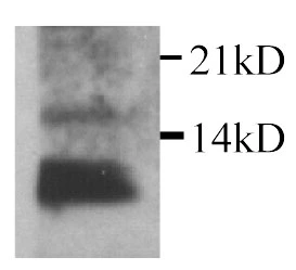 Western blot detection of rat IL-15 protein in COS7 transfected supernatant. Western blot detection of rat IL-15 protein in COS7 transfected supernatant.