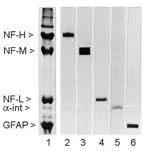 Rat spinal cord homogenate showing the major intermediate filament proteins of the nervous system (lane 1). The remaining lanes show blots of this material stainted with various antibodies including GTX27256 (lane 3). Rat spinal cord homogenate showing the major intermediate filament proteins of the nervous system (lane 1). The remaining lanes show blots of this material stainted with various antibodies including GTX27256 (lane 3).