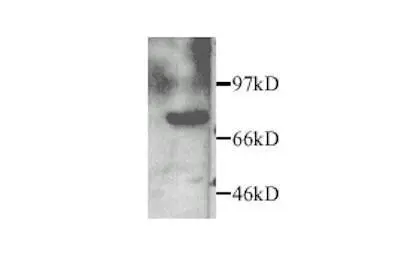 MMP2 antibody MMP2 antibody