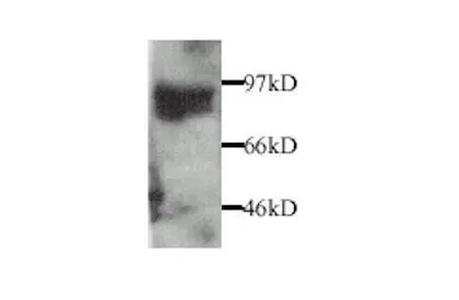 MMP9 antibody
