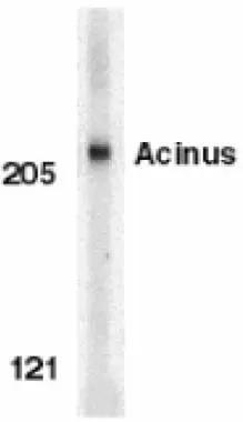 Western blot analysis of Acinus in K562 whole cell lysate with Acinus antibody (IN) (GTX27354) at 1microg/ml.