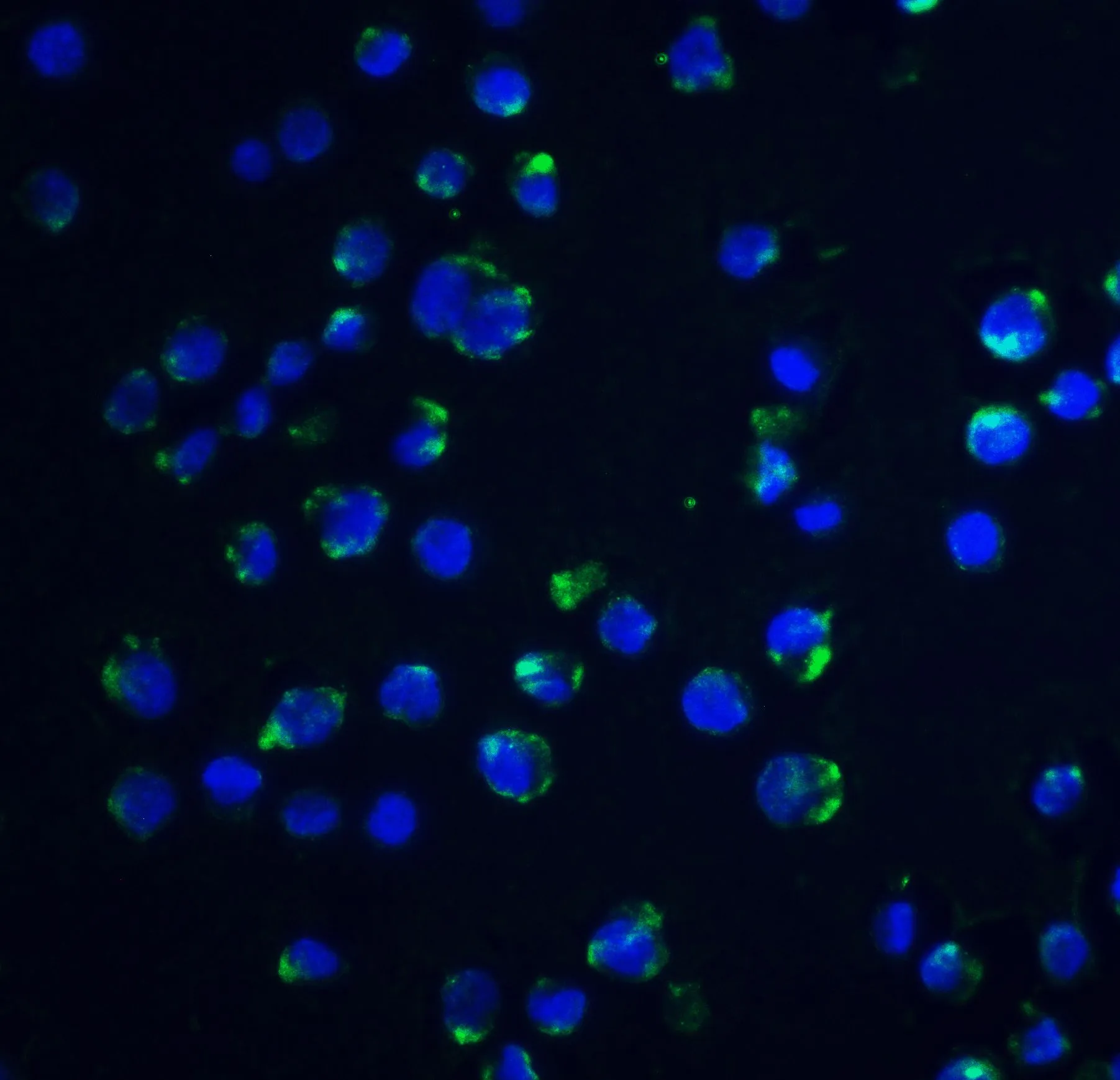 ICC/IF analysis of K562 cells using GTX27354 Acinus antibody. Green : Primary antibody Blue : DAPI Dilution : 20 microg/ml
