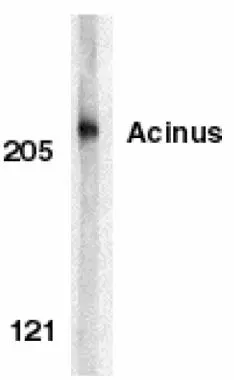 Western blot analysis of Acinus in K562 whole cell lysate with Acinus antibody (NP) (GTX27355)at 1microg/ml.