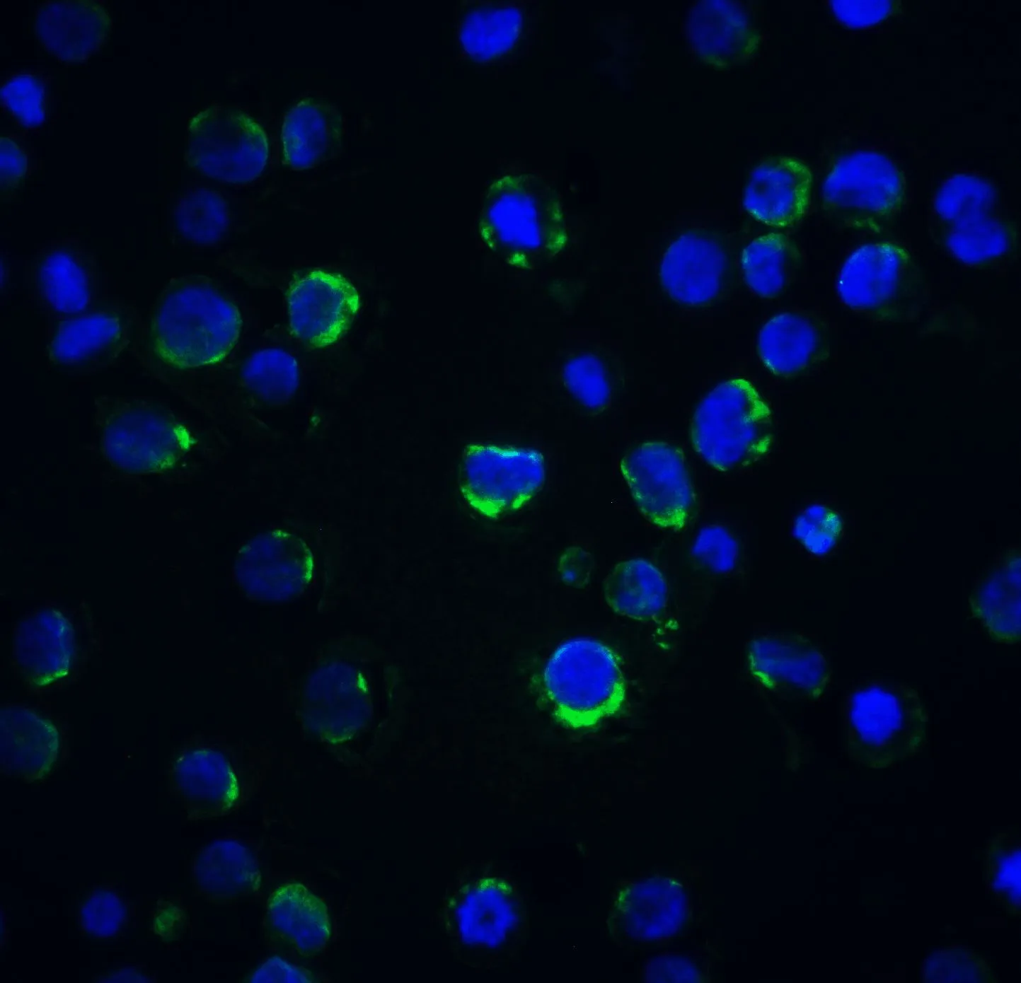 ICC/IF analysis of K562 cells using GTX27355 Acinus antibody. Green : Primary antibody Blue : DAPI Dilution : 20 microg/ml