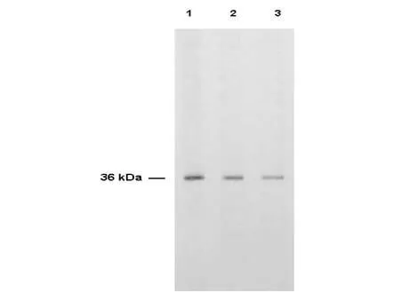 WB analysis of HeLa whole cell lysate using GTX27398 Thymidylate synthase antibody. Dilution : Lane 1 : 1:2000 Lane 2 : 1:5000 Lane 3 : 1:10000 Loading : 4 microg WB analysis of HeLa whole cell lysate using GTX27398 Thymidylate synthase antibody. Dilution : Lane 1 : 1:2000 Lane 2 : 1:5000 Lane 3 : 1:10000 Loading : 4 microg