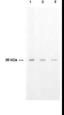 Anti-TS is shown to detect thymidylate synthase present in a HeLa cell extract. Each lane is estimated to contain 4 microg of protein. Lanes 1, 2 and 3 represent 1:2,000, 1:5,000 and 1:10,000 fold dilutions of the antibody. Detection was made using HRP Rabbit-anti-Sheep IgG diluted 1:1,000 and color development using TMB (TMBM-100) substrate.