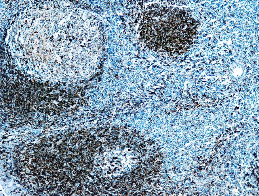 IHC-P analysis of human tonsil tissue using GTX27491 CD79a antibody [HM47/A9] (ready-to-use).