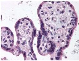 GeneTexs Anti-IKKs antibody was diluted 1:500 to detect IKKs in human placenta tissue. Tissue was formalin fixed and paraffin embedded. No pre-treatment of sample was required. The image shows the localization of antibody as the precipitated red signal, with a hematoxylin purple nuclear counter stain. GeneTexs Anti-IKKs antibody was diluted 1:500 to detect IKKs in human placenta tissue. Tissue was formalin fixed and paraffin embedded. No pre-treatment of sample was required. The image shows the localization of antibody as the precipitated red signal, with a hematoxylin purple nuclear counter stain.