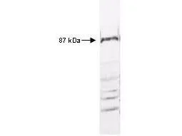 Western blot of anti-IKKs antibody (GTX27611) reacted with HeLa cell extract. All incubations except color development were performed using TBS supplemented with 0.1% Tween-20 at room temperature. The membrane was blocked in 5% dry milk for 2 h. After washing, a 1:500 dilution of the primary antibody was added to the membrane and incubated for 2 h. Washes with buffer were performed 4 times for 5 each. The western blot was incubated with secondary antibody (HRP Goat anti Rabbit IgG (H&L)) diluted 1:2,000 for 1h. Washes with TBS preceded color development.