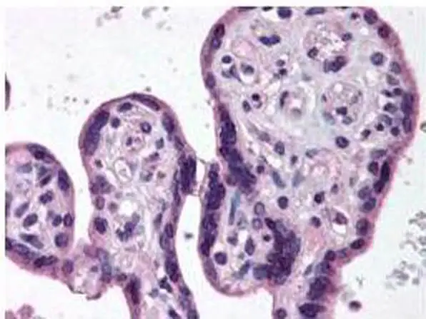IHC-P analysis of human placenta tissue using GTX27611 IKK beta antibody. Dilution : 1:500