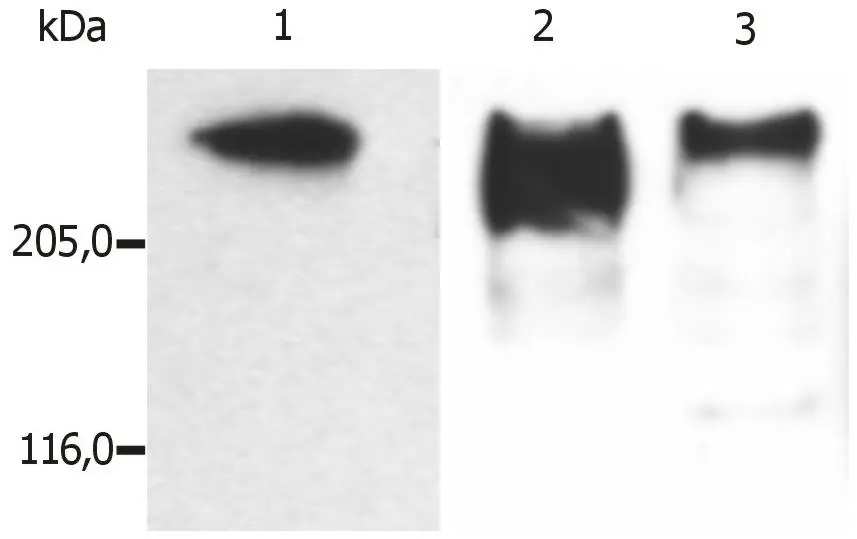 WB analysis of microtubules partially purified from pig brain lysate using GTX27756 MAP2 antibody [MT-01]. Lane 1 : GTX27756 Lane 2 : GTX79912 Lane 3 : GTX79911