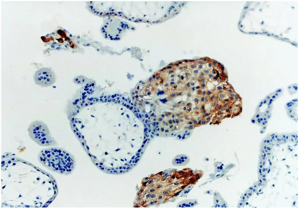 IHC-P analysis of first trimester placenta tissue using GTX27759 HLA-G antibody [MEM-G/1].